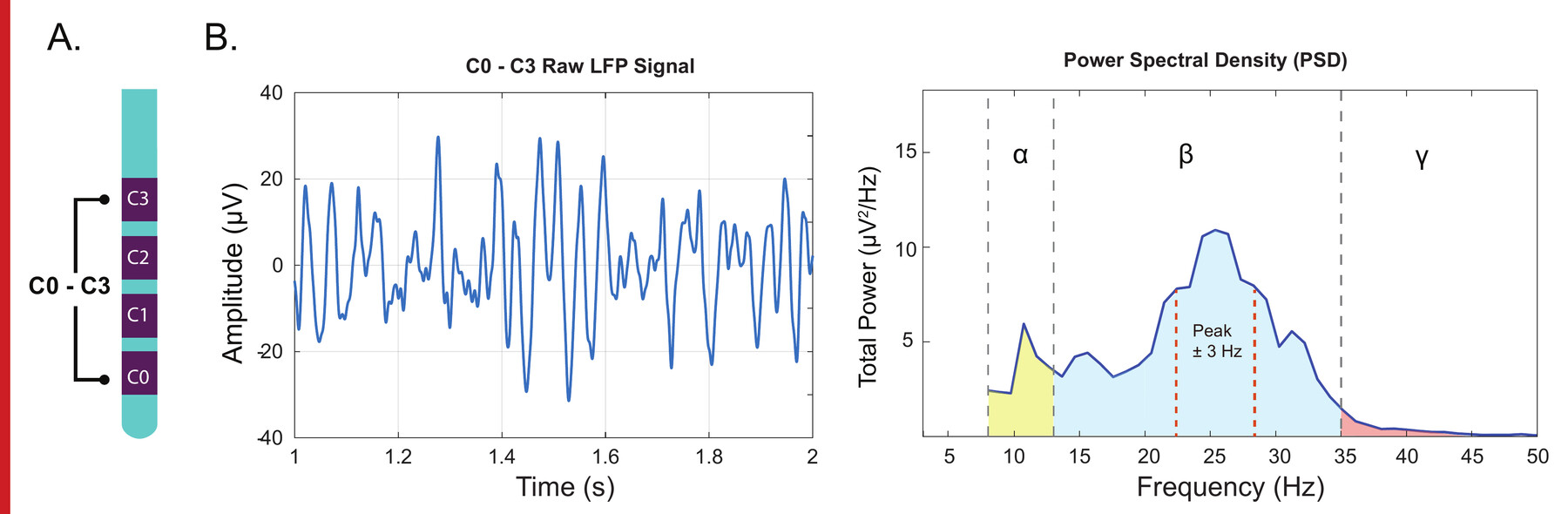 A. DBS lead with labeled ring electrodes C0 through C3. B. Bipolar LFP time series between contacts 0 and 3 and the corresponding power spectral density, with color-coded alpha, beta, and gamma frequency bands